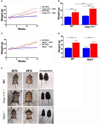 Absence of the Caspases 1/11 Modulates Liver Global Lipid Profile and Gut Microbiota in High-Fat-Diet-Induced Obese Mice